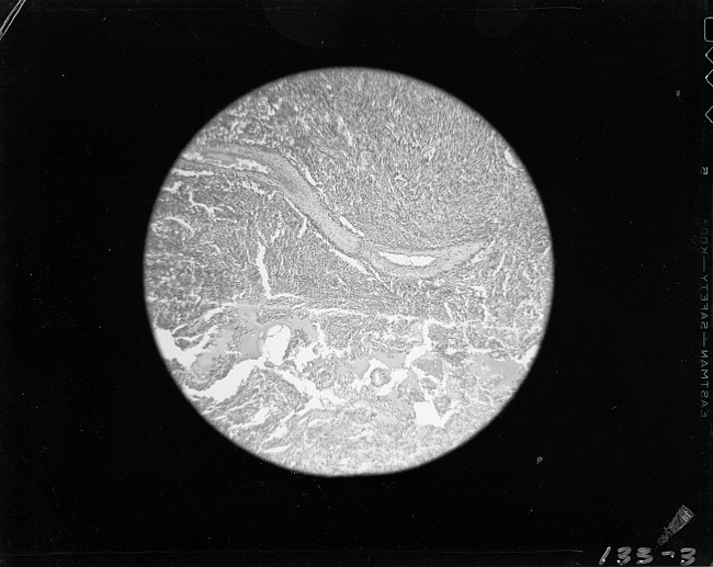 Photomicrograph with nuclei