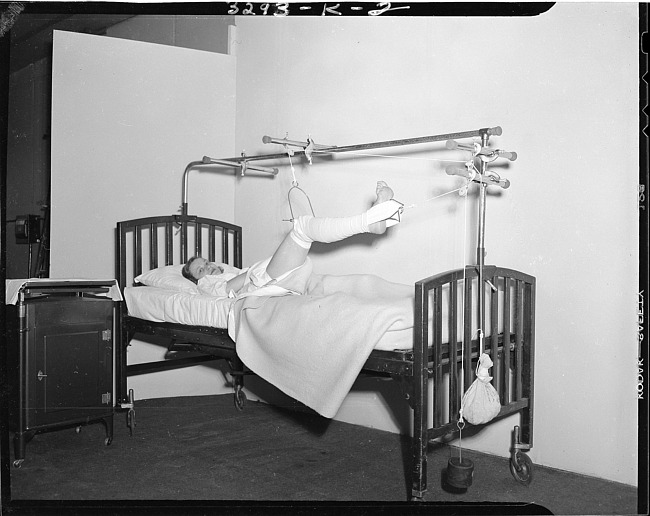 Woman in hospital bed with leg in frame